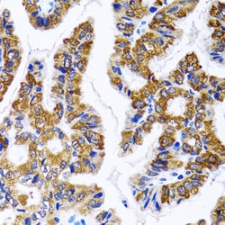 Invitrogen FASN Polyclonal Antibody 100 &mu;L; Unconjugated:Antibodies,