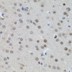 Invitrogen n-Myc Polyclonal Antibody 100 &mu;L | Buy Online | Invitrogen&trade; | Fisher Scientific
