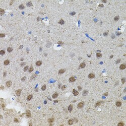 Invitrogen n-Myc Polyclonal Antibody 100 &mu;L | Buy Online | Invitrogen&trade; | Fisher Scientific