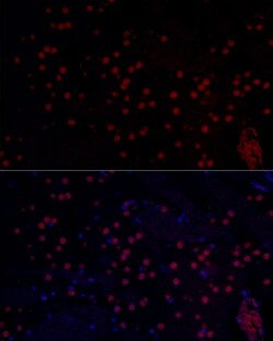 Invitrogen n-Myc Polyclonal Antibody 100 &mu;L | Buy Online | Invitrogen&trade; | Fisher Scientific