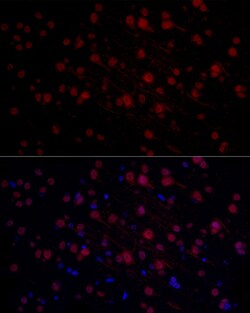 Invitrogen n-Myc Polyclonal Antibody 100 &mu;L | Buy Online | Invitrogen&trade; | Fisher Scientific