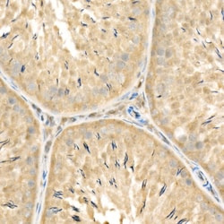 Invitrogen RelB Polyclonal Antibody 100 &mu;L; Unconjugated:Antibodies,