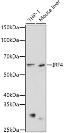 Invitrogen IRF4 Polyclonal Antibody 100 &mu;L; Unconjugated:Antibodies,