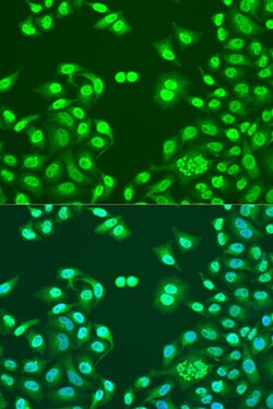 NuMA Polyclonal Antibody, Invitrogen 100 &mu;L; Unconjugated:Antibodies,