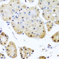 NuMA Polyclonal Antibody, Invitrogen 100 &mu;L; Unconjugated:Antibodies,