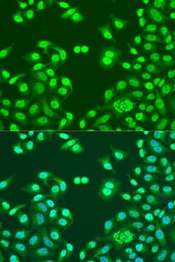 NuMA Polyclonal Antibody, Invitrogen 100 &mu;L; Unconjugated:Antibodies,