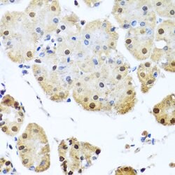 NuMA Polyclonal Antibody, Invitrogen 100 &mu;L; Unconjugated:Antibodies,