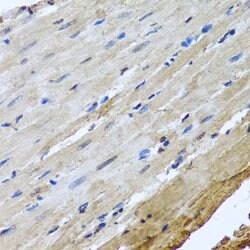 NuMA Polyclonal Antibody, Invitrogen 100 &mu;L; Unconjugated:Antibodies,