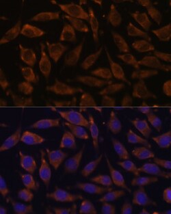 Invitrogen NOTCH2 Polyclonal Antibody 100 &mu;L; Unconjugated:Antibodies,