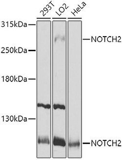 Invitrogen NOTCH2 Polyclonal Antibody 100 &mu;L; Unconjugated:Antibodies,