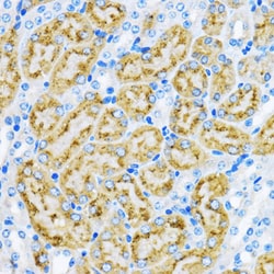 Invitrogen EEA1 Polyclonal Antibody 100 &mu;L | Buy Online | Invitrogen&trade; | Fisher Scientific