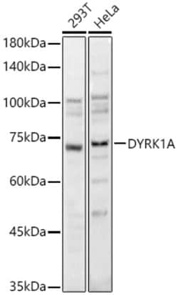 Invitrogen DYRK1A Polyclonal Antibody 100 &mu;L; Unconjugated:Antibodies,