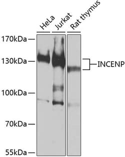 Invitrogen INCENP Polyclonal Antibody 100 &mu;L; Unconjugated:Antibodies,