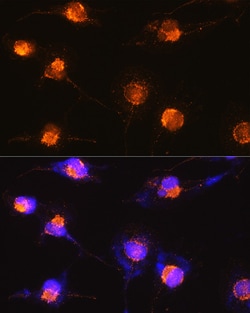 Invitrogen S100B Polyclonal Antibody 100 &mu;L; Unconjugated:Antibodies,