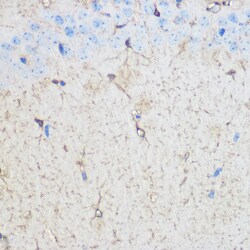 Invitrogen S100B Polyclonal Antibody 100 &mu;L; Unconjugated:Antibodies,