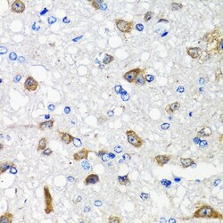 Invitrogen ACVR1C Polyclonal Antibody 100 &mu;L; Unconjugated:Antibodies,