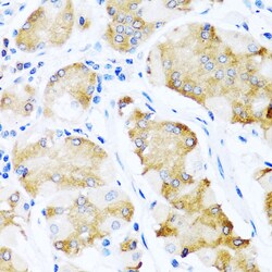 Invitrogen ACVR1C Polyclonal Antibody 100 &mu;L; Unconjugated:Antibodies,