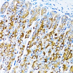 Invitrogen ACVR1C Polyclonal Antibody 100 &mu;L; Unconjugated:Antibodies,