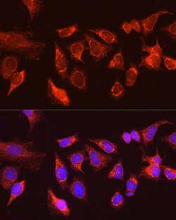 Invitrogen ATG13 Polyclonal Antibody 100 &mu;L; Unconjugated:Antibodies,