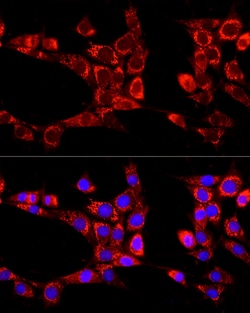 Invitrogen ATG13 Polyclonal Antibody 100 &mu;L; Unconjugated:Antibodies,
