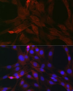 Invitrogen SOCS3 Polyclonal Antibody 100 &mu;L; Unconjugated:Antibodies,