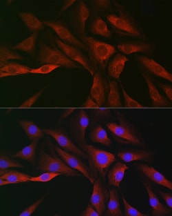 Invitrogen SOCS3 Polyclonal Antibody 100 &mu;L; Unconjugated:Antibodies,