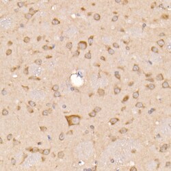 Invitrogen SOCS3 Polyclonal Antibody 100 &mu;L; Unconjugated:Antibodies,