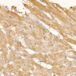Invitrogen SOCS3 Polyclonal Antibody 100 &mu;L; Unconjugated:Antibodies,