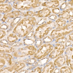 Invitrogen SOCS3 Polyclonal Antibody 100 &mu;L; Unconjugated:Antibodies,