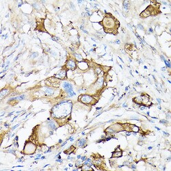 Invitrogen MMP7 Polyclonal Antibody 100 &mu;L; Unconjugated:Antikörper