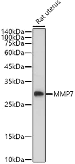 Invitrogen MMP7 Polyclonal Antibody 100 &mu;L; Unconjugated:Antikörper