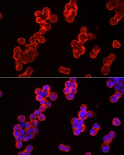 Invitrogen c-Cbl Polyclonal Antibody 100 &mu;L; Unconjugated:Antibodies,