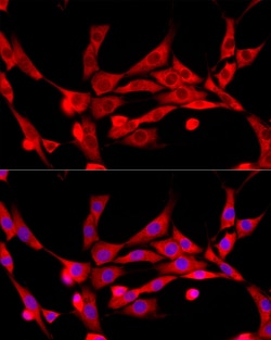 Invitrogen c-Cbl Polyclonal Antibody 100 &mu;L; Unconjugated:Antibodies,
