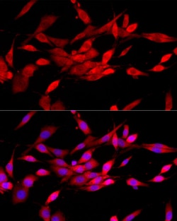 Invitrogen c-Cbl Polyclonal Antibody 100 &mu;L; Unconjugated:Antibodies,