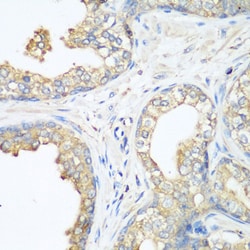 Invitrogen c-Cbl Polyclonal Antibody 100 &mu;L; Unconjugated:Antibodies,