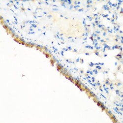 Invitrogen c-Cbl Polyclonal Antibody 100 &mu;L; Unconjugated:Antibodies,