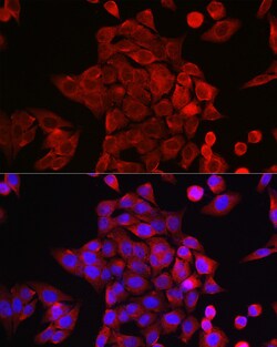 Invitrogen STAT6 Polyclonal Antibody 100 &mu;L; Unconjugated:Antibodies,