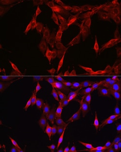 Invitrogen STAT6 Polyclonal Antibody 100 &mu;L; Unconjugated:Antibodies,