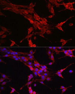 Invitrogen STAT6 Polyclonal Antibody 100 &mu;L; Unconjugated:Antibodies,