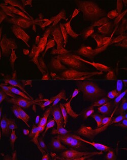Invitrogen STAT6 Polyclonal Antibody 100 &mu;L; Unconjugated:Antibodies,
