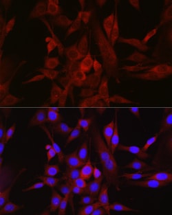 Invitrogen STAT6 Polyclonal Antibody 100 &mu;L; Unconjugated:Antibodies,