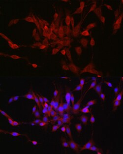 Invitrogen STAT6 Polyclonal Antibody 100 &mu;L; Unconjugated:Antibodies,