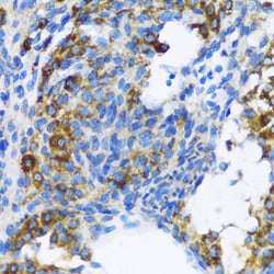 Invitrogen PTCH Polyclonal Antibody 100 &mu;L | Buy Online | Invitrogen&trade; | Fisher Scientific