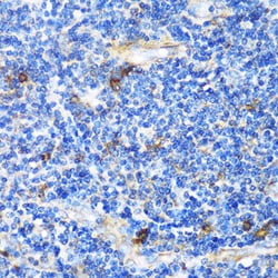 Invitrogen PTCH Polyclonal Antibody 100 &mu;L | Buy Online | Invitrogen&trade; | Fisher Scientific