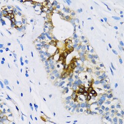 Invitrogen PTCH Polyclonal Antibody 100 &mu;L | Buy Online | Invitrogen&trade; | Fisher Scientific