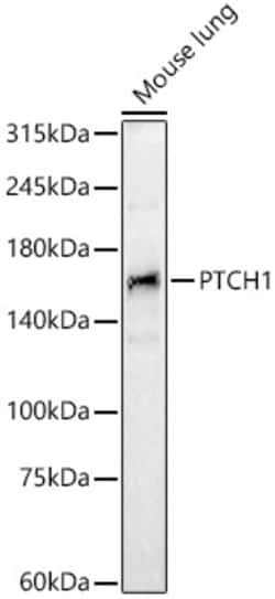 Invitrogen PTCH Polyclonal Antibody 100 &mu;L | Buy Online | Invitrogen&trade; | Fisher Scientific
