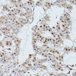 Invitrogen CDK9 Polyclonal Antibody 100 &mu;L; Unconjugated:Antibodies,