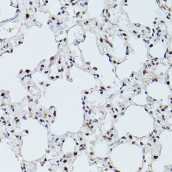 Invitrogen CDK9 Polyclonal Antibody 100 &mu;L; Unconjugated:Antibodies,