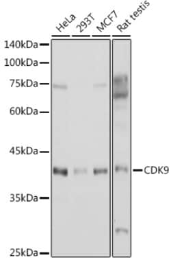 Invitrogen CDK9 Polyclonal Antibody 100 &mu;L; Unconjugated:Antibodies,