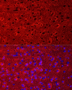Invitrogen GLT-1 Polyclonal Antibody 100 &mu;L; Unconjugated:Antibodies,